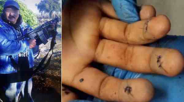 “El Kalimba” intentaba alterar sus huellas digitales.