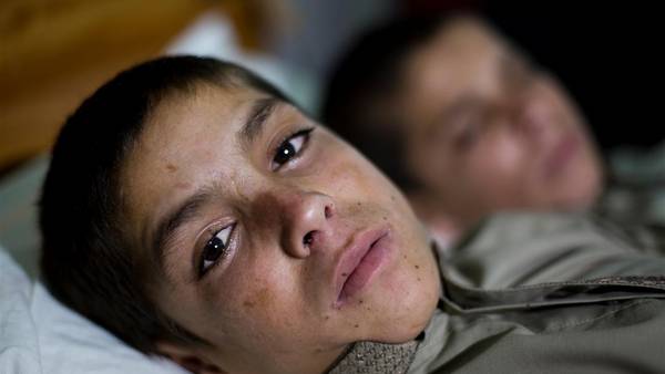 Shoaib Ahmed y Abdul Rasheed, de 9 y 13 años, sufren este mal desde que nacieron. FOTO AP