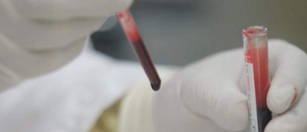 Crean arroz con proteína de sangre humana | Con el descubrimiento se reduciría el déficit de donantes de sangre.