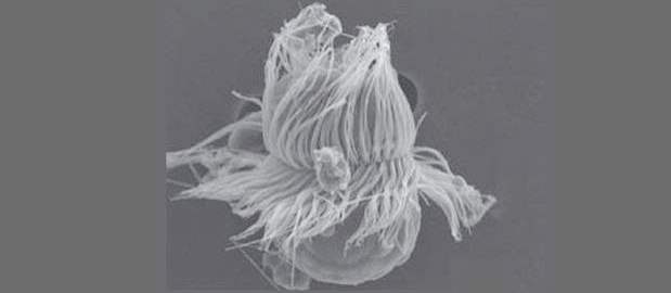 Descubren organismo mitad planta-mitad animal | Cortesía | Es una especie única de organismo unicelular, cubierto por cientos de tentáculos pequeñísimos llamados cilios y fue hallado en la bahía Niva en Dinamarca por Ojvind Moestrup y su grupo.