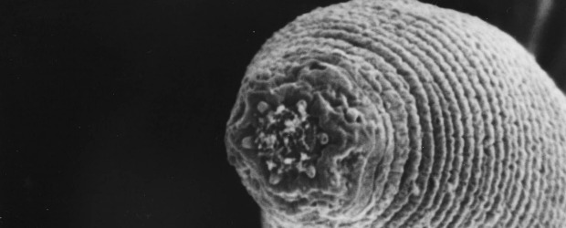 Hallan al diablo: vive en el fondo de la tierra | Cortesía. Universidad Ghent, Bélgica-nature | En el agua analizada que proviene de las profundidades de la corteza solo se encontraron individuos de H. mephisto, lo que de acuerdo con los científicos evidencia un amalgama de conceptos evolutivos filogenéticos de especies. Su parecido más cercano es con H. gingivalis.