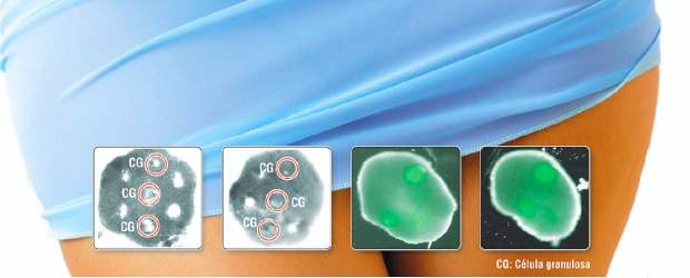 Ovario artificial es realidad | Shutterstock-brown University | En las imágenes al centro se observa el desarrollo del ovario artificial: izquierda, las células teca envuelven las células de granulosa (marcadas). En las dos últimas, el tejido a las 48 horas y a los cinco días.