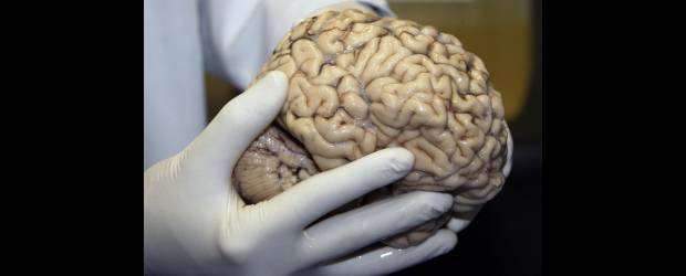 Neurobanco: una cuenta de 170 cerebros | Jaime Pérez | Los órganos son utilizados para investigaciones encaminadas al entendimiento de las enfermedades del cerebro, con el objetivo de encontrar soluciones para tratarlas, mejorar la calidad de vida de los afectados y en el mejor de los casos, curarlas.