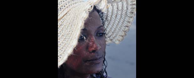 No le tema a la psoriasis | Cortesía | Las personas que tienen la enfermedad presentan problemas sicológicos porque la sociedad se encarga de aislarlos y esta enfermedad no es contagiosa.