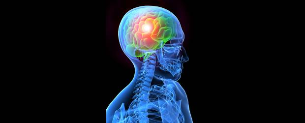 Es mejor no darse en la cabeza | Shutterstock | El daño en un nervio puede desencadenar la muerte de otros.