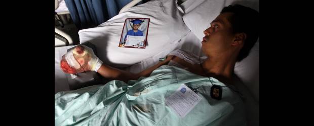 Óscar se quedó sin Navidad por un taco | Manuel Saldarriaga | A Óscar Darío Restrepo un taco de pólvora, celebrando la llegada de diciembre, paradójicamente, le amargó la Navidad y la de su hijo de 5 años. Quedó sin tres dedos de la mano derecha, lo que piensa, lo limitará para seguir lavando carros o trabajar en construcción, que era como se ganaba la vida.