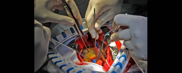 Reparando el refugio del alma | Henry Agudelo | El corazón, el órgano más importante del sistema circulatorio, es un puño de sangre que tiene vida propia y es la obsesión del doctor Alejandro Escobar, quien en el Instituto Corbic de Envigado, lleva 447 operaciones a corazón abierto. El homenaje a la vida de un hombre que ama lo que hace.