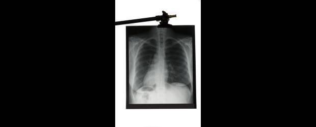 Tecnología más acertada para los diagnósticos | La radiografía sigue siendo uno de los exámenes más comunes para ver de cerca las estructuras óseas del cuerpo.