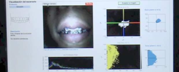 ImagenMantis une la visión con la tecnología en salud | Cortesia | Mediante el convenio CES-Escuela de Ingeniería, se ofrece el programa de Ingeniería Biomédica. Allí, el grupo de investigación trabaja en varios proyectos.