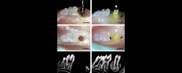 Un ratón estrena diente raro | Cortesía Plos One | En las imágenes se aprecia el hueco abierto para implantar el diente cultivado (derecha). Un procedimiento exitoso.