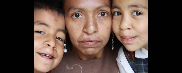Jazz y tango por la familia Suárez | Róbinson Sáenz | Juan Carlos, Adriana y Lina sufren de labio leporino y paladar hendido. A los niños les están haciendo cirugías. A la madre nunca la atendieron, pero anhela primero una dentadura, pues hace años se quedó sin ella. La enfermedad no los acompleja. La foto se publica con autorización de los padres.