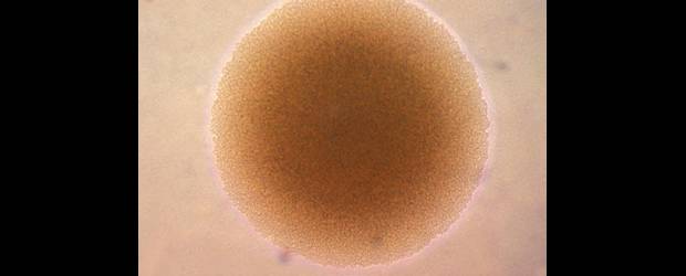 Una gonorrea en el papel de secuestradora | Cortesía | Fotomicrografía de una colonia de la bacteria Neisseria gonorrhoeae magnificada 100 veces. Ahora tiene un pedacito del ADN humano.