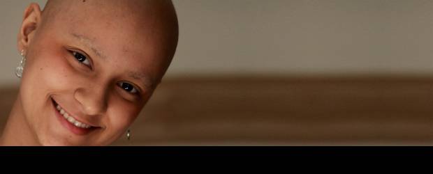 Julio Herrera | El sueño de ser modelo quedó atrás. "Ya no podría por esta gran cicatriz", dice mientras se descubre la espalda. Entonces habla de su nueva meta: convertirse en odontóloga.