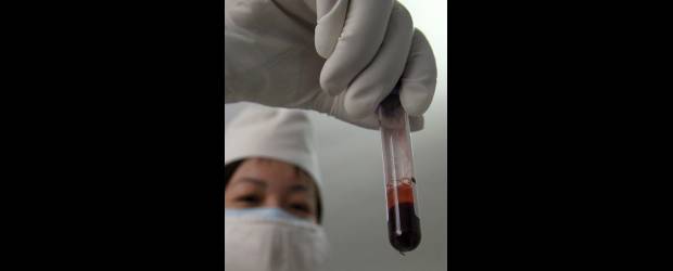 Crean fármaco para frenar VIH | Archivo | Este nuevo tratamiento es costoso, su fabricación es complicada y debe ser administrado por vía intravenosa.