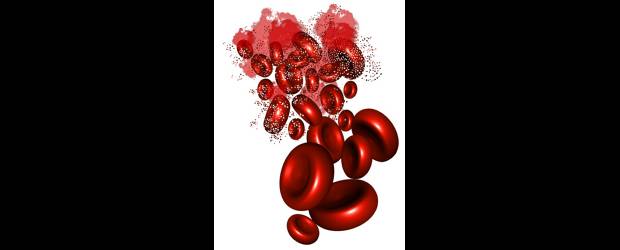 Cuidado con los glóbulos rojos | Shutterstock | Esta enfermedad está catalogada como huérfana.