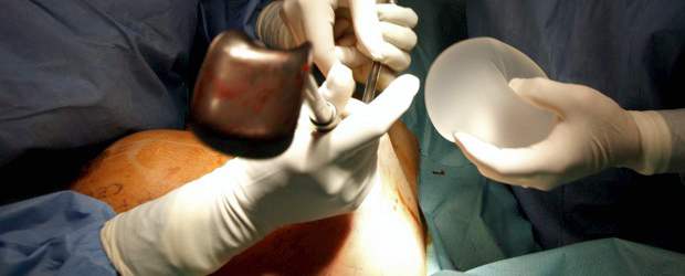 Recomiendan revisar implantes mamarios | Reuters | Las mujeres con implantes mamarios fabricados por PIP no tienen razones para quitárselos, pero deberían buscar consejo médico si creen que se han roto.