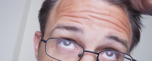 Sí es posible ganarle a la calvicie | Shutterstock | La escala Hamilton clasifica los niveles de avance de la alopecia. Va del uno al siete y fue desarrollada a mediados del siglo pasado por James Hamilton. Cerca de 700 personas fueron estudiadas entonces por el médico inglés.