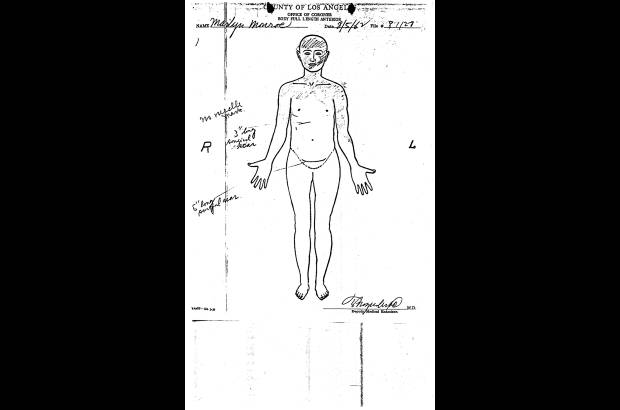 AP - Documento proporcionado por el m&#233;dico forense del Condado de Los &#193;ngeles muestra el informe de la autopsia a la actriz, Marilyn Monroe, con fecha 5 de agosto 1962.
