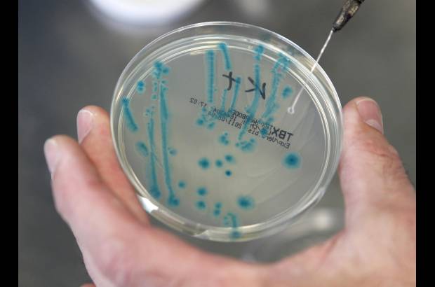 Reuters - Los cient&#237;ficos alemanes fueron burlados por una cepa de la bacteria Escherichia coli enterohemorr&#225;gica, durante varios d&#237;as buscaron, sin resultados, el origen de la bacteria que ha dejado m&#225;s de 30 muertos en Alemania.