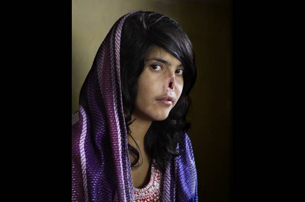 AP - La fotógrafa sudafricana Jodi Bieber ganó el World Press Photo por una fotografía de Bibi Aisha, una mujer afgana de 18 años a la que le fueron amputadas la nariz y las orejas por no obedecer a su marido.