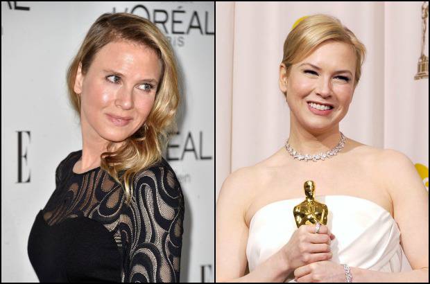 AFP-AP - Ren&#233;e Zellweger, la recordada actriz de la saga &quot;Bridget Jones&quot;, reapareci&#243; la noche del lunes en una gala celebrada en Los &#193;ngeles (E.U.) y caus&#243; revuelo por el evidente cambio en su rostro, que provoc&#243; numerosos comentarios en la prensa, que lo califica de &quot;irreconocible&quot;.