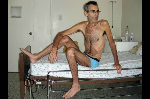 Reuters - Franklin Brito, productor agr&#237;cola de 49 a&#241;os de edad, mantuvo sucesivas huelgas de hambre en protesta contra el Gobierno venezolano.