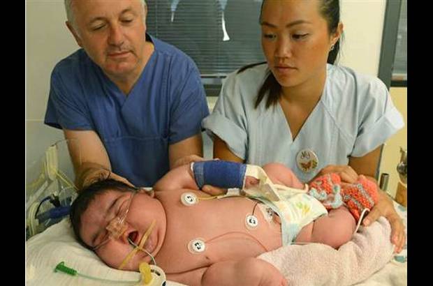 AP - En Leipzig, Alemania, naci&#243; la beb&#233; m&#225;s pesada registrada en ese pa&#237;s. Jasleen pes&#243; 6,11 kilos, naci&#243; por parto natural y su peso se dio por una diabetes gestacional que ten&#237;a la madre y que no fue diagnosticada a tiempo.
