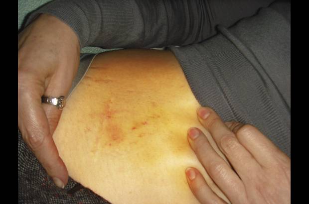 Reuters - Tambi&#233;n en algunas fotos aparece con lesiones en un brazo y un codo, que supuestamente le infligieron el pasado viernes tres hombres cuando se neg&#243; a abandonar la c&#225;rcel de la ciudad oriental de J&#225;rkov para someterse a rehabilitaci&#243;n por la hernia discal que padece.