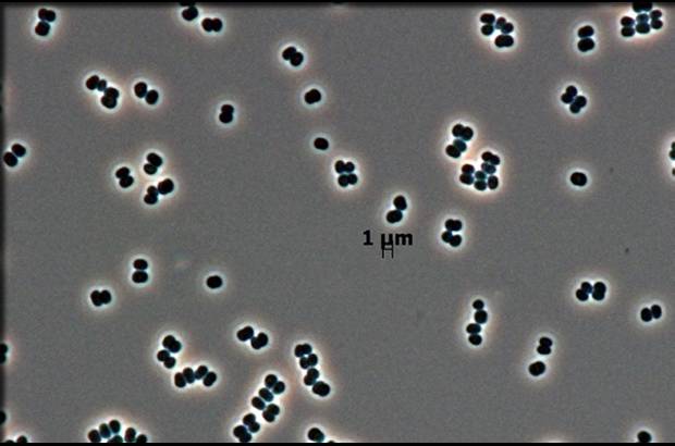 Foto Leibniz Institute - Bacteria (Tersicoccus phoenicis) hallada en sitios donde se construyen naves espaciales, podr&#237;a invadir otros planetas.