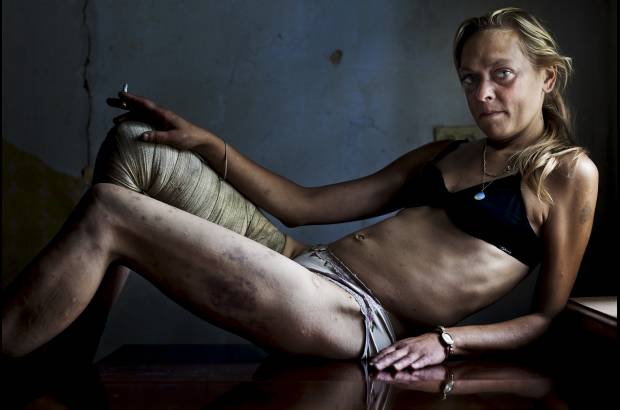 Reuters - El periodista independiente sudafricano Brent Stirton gan&#243; el primer lugar en la categor&#237;a Problemas Contempor&#225;neos con esta foto de Mar&#237;a, una trabajadora sexual y drogadicta ucraniana.