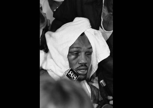 AP - Frazier despu&#233;s de la pelea ante Ali del 1 de octubre de 1975 en la velada &#39;The Thrilla in Manila&#39; (Conmoci&#243;n en Manila), donde Eddie Futch, el gran entrenador de Frazier, se apiad&#243; de su pupilo y detuvo el combate despu&#233;s del decimocuarto asalto.