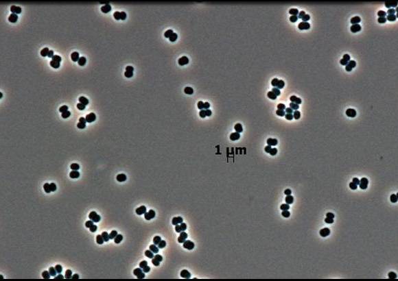 Foto Leibniz Institute - Bacteria (Tersicoccus phoenicis) hallada en sitios donde se construyen naves espaciales, podr&#237;a invadir otros planetas.