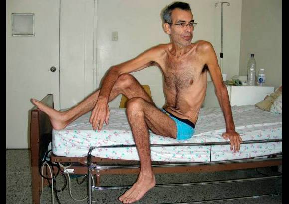 Reuters - Franklin Brito, productor agr&#237;cola de 49 a&#241;os de edad, mantuvo sucesivas huelgas de hambre en protesta contra el Gobierno venezolano.
