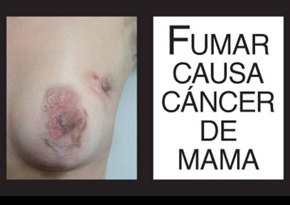 Foto Cortesía - El Ministerio de Salud y Protección Social publicó las imágenes de advertencia sanitarias para las cajetillas de cigarrillo 2013 - 2014, de acuerdo a la resolución 3961 del 2009, por la cual se establecen los requisitos de empaquetado y etiquetado del tabaco y sus derivados.