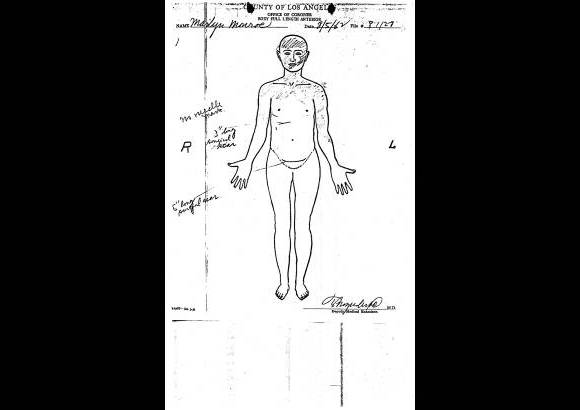 AP - Documento proporcionado por el m&#233;dico forense del Condado de Los &#193;ngeles muestra el informe de la autopsia a la actriz, Marilyn Monroe, con fecha 5 de agosto 1962.