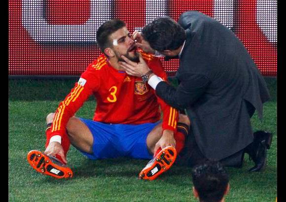 Reuters - Gerard Piqué, defensa del FC Barcelona, recibió tras el partido ante Honduras tres puntos de sutura en el labio superior al recibir un golpe involuntario con la bota por parte de un contrario.