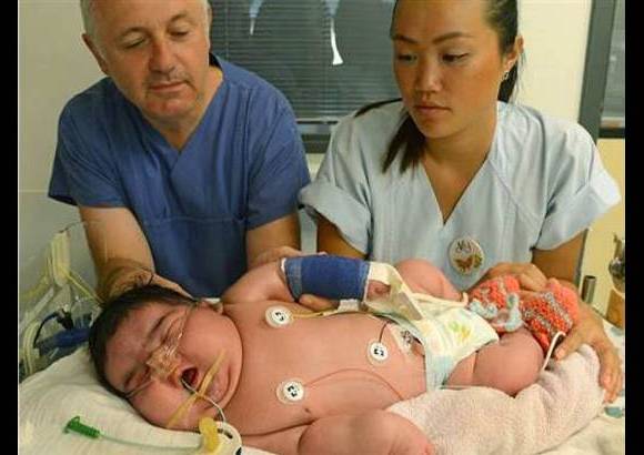 AP - En Leipzig, Alemania, naci&#243; la beb&#233; m&#225;s pesada registrada en ese pa&#237;s. Jasleen pes&#243; 6,11 kilos, naci&#243; por parto natural y su peso se dio por una diabetes gestacional que ten&#237;a la madre y que no fue diagnosticada a tiempo.
