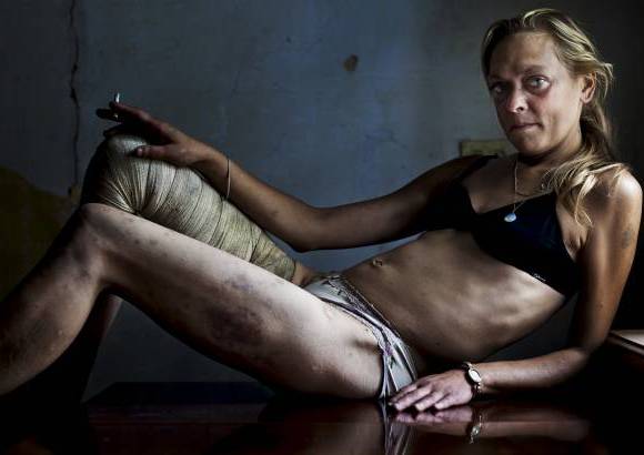 Reuters - El periodista independiente sudafricano Brent Stirton gan&#243; el primer lugar en la categor&#237;a Problemas Contempor&#225;neos con esta foto de Mar&#237;a, una trabajadora sexual y drogadicta ucraniana.