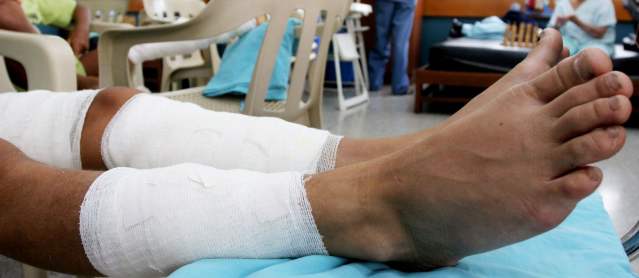 Con prevención, Barranquilla y Santa Marta tienen cero quemados