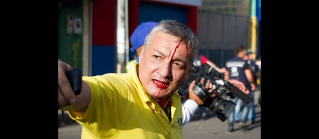 Agresión a periodistas: hay 2 investigaciones | El periodista Oscar Montoya, luego de la agresión de miembros del Esmad en el sector de Cisneros. FOTO Esteban Vanegas