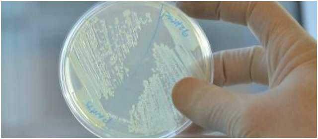 Los aislamientos son comunes en los hospitales | El cultivo es básico para diagnosticar una infección y recetar el antibiótico correcto. Acá, E. coli. FOTO WYSS INSTITUTE