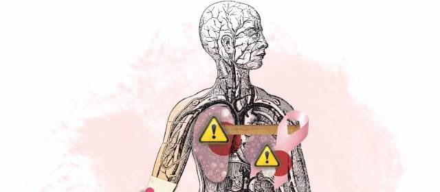 Cáncer: es más barato prevenir y menos doloroso
