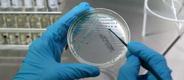 Bacterias que nos ayudan | Según los expertos, la mayoría de las bacterias son inofensivas. FOTO EFE REPORTAJES