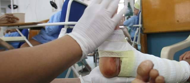 70 personas han resultado quemadas con pólvora en primeros días de diciembre | Foto archivo