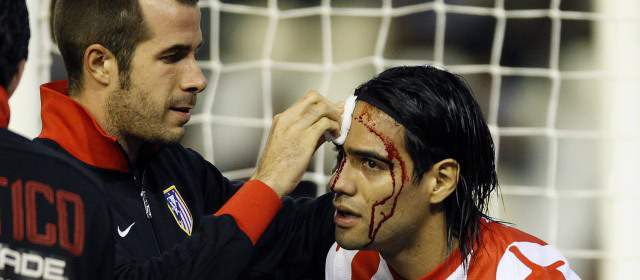 Atlético de Madrid volvió a entrenamientos luego de romper su racha histórica | Atlético de Madrid perdió su invicto y Falcao sufrió un golpe en la cabeza. Foto: Reuters