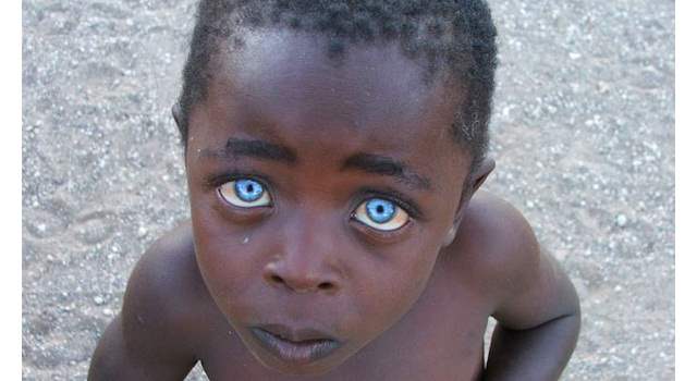 Theuns, el niño con los ojos de zafiro | Foto: Copyright Vanessa Bristow