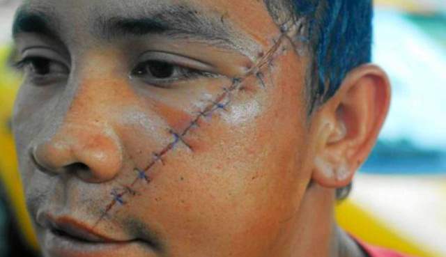 Joven santandereano necesita con urgencia una cirugía maxilofacial |