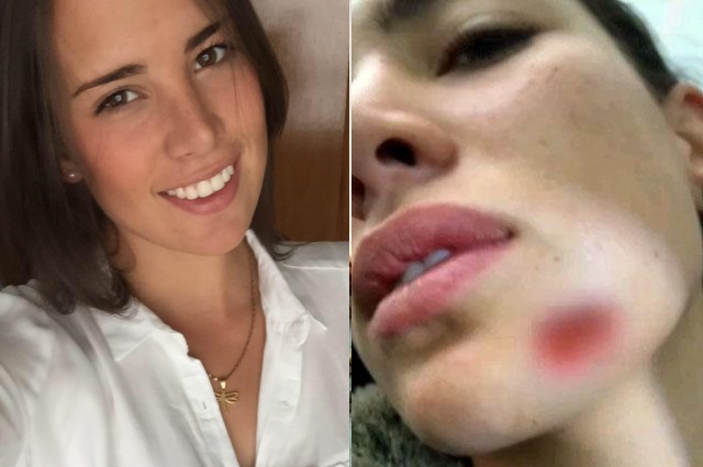 La modelo bogotana, María José Rivas, aspirante al Reinado Nacional de Belleza, denunció el pasado lunes ante la Fiscalía un ataque brutal por parte de su exnovio.