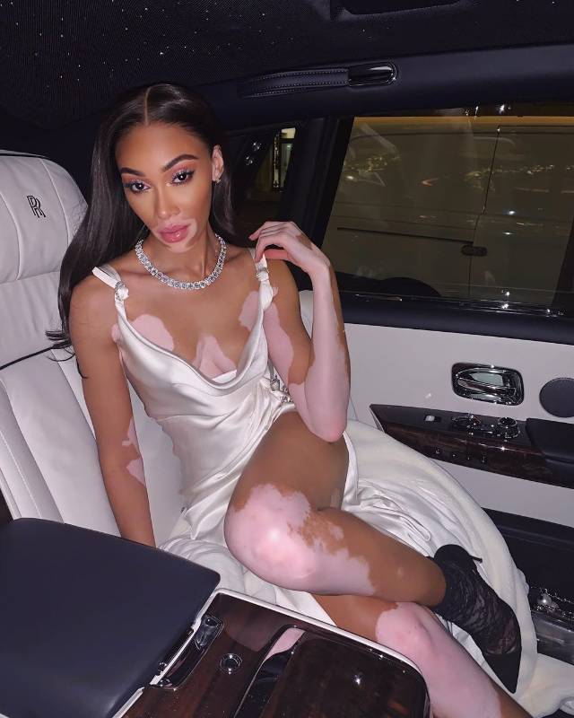 Winnie Harlow es canadiense y tiene 25 años. Es considerada como la primera modelo con vitíligo, una enfermedad que provoca la pigmentación de la piel. Por su estilo diverso y auténtico, en 2019, la Revista Vogue dijo que la modelo ha “marcado un antes y un después en la moda”. Ha sido portada de la Revista Vogue varias veces, participó en America´s Next Top Model, ha colaborado con Christian Dior y en 2018 inició como “ángel” de Victoria´s Secret. Foto: @winnieharlow