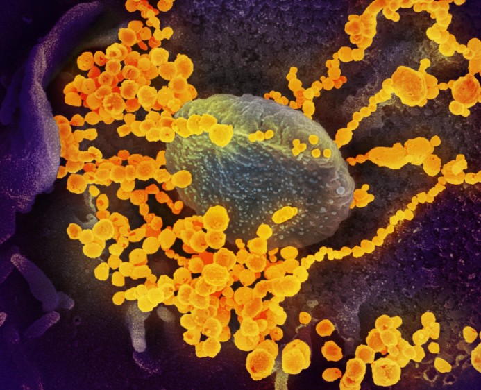 El tratamiento de baja dosis de dexametasona con esteroides es parte del mayor ensayo del mundo que prueba los tratamientos existentes para ver si también funcionan para el nuevo coronavirus. FOTO NIAID (Flickr)